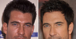Dylan McDermott: Good Genes or Good Docs?