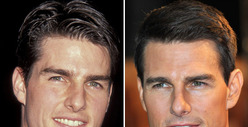 Tom Cruise: Good Genes or Good Docs?