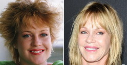 Melanie Griffith: Good Genes or Good Docs?