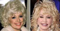 Dolly Parton: Good Genes or Good Docs?