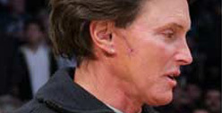 Bruce Jenner -- I'm Scarred from Skin Cancer