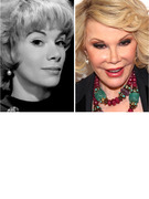 Joan Rivers Documents Her "734th" Plastic Surgery!
