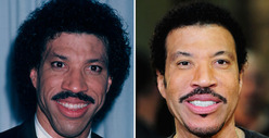 Lionel Richie: Good Genes or Good Docs?