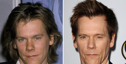 Kevin Bacon: Good Genes or Good Docs?