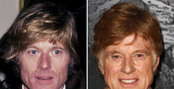 Robert Redford: Good Genes or Good Docs?