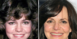 Sally Field: Good Genes or Good Docs?