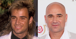 Andre Agassi: Good Genes or Good Docs?