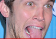 Phillip Phillips -- Under the Knife On Tuesday