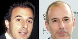 Matt Lauer: Good Genes or Good Docs?