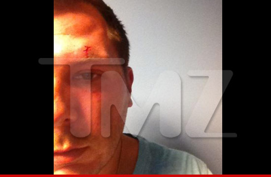 0609_jersey_shore_injury