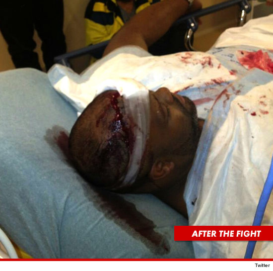 Chris Browns bodyguard Big Pat was also hospitalized.