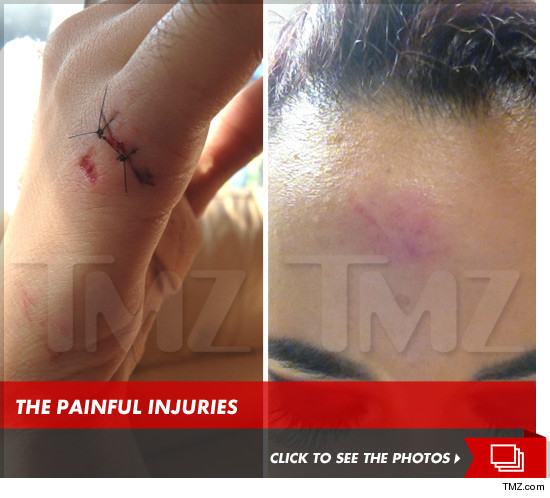 0615_PAINFUL_INJURIES