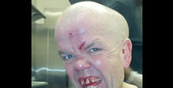 'Half Pint Brawler' -- K.O.'d by Cement Face Dive ... Hospitalized