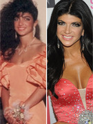 "Real Housewives" Surgery Revealed -- See Before & After Pics!