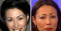 Ann Curry -- Good Genes or Good Docs?