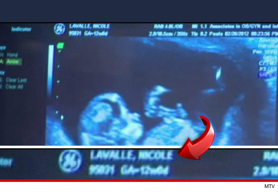 Snooki's ultrasound shows unborn baby.