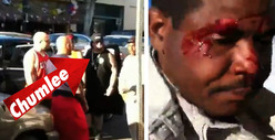 'Pawn Stars' Chumlee -- BLOODY FIGHT on Hollywood Blvd.