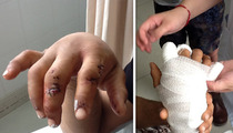 Raz B Hand Injury -- My Hand Won't Work Right for 3 Months!