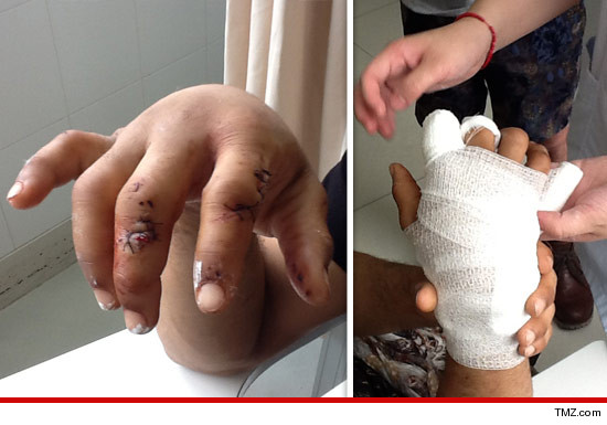 0713_raz_b_hand_tmz