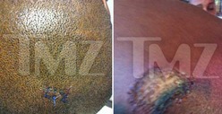 DMX Crash -- The Docs Stitched My Head Up! 
