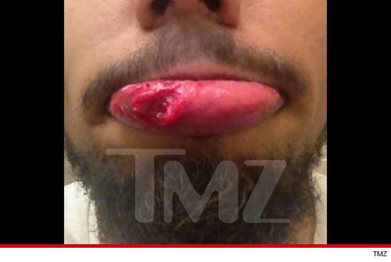 0806_montee_ball_victim2