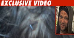 Bam Margera -- Check Out My Bloody, Stapled Head