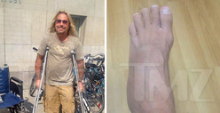 Vince Neil -- The Show Must Go On ... Even With My Broken Foot! 