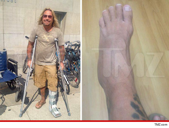 0913-vince-neil-tmz-ankle