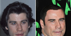 John Travolta: Good Genes or Good Docs?