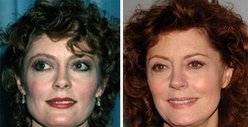 Susan Sarandon: Good Genes or Good Docs?