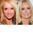 Kim Richards' New Nose -- See "Real Housewives" Pre-Plastic Surgery!