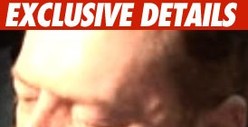 Larry Flynt Gets Over Blown