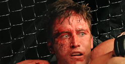 UFC's Stephan Bonnar -- Juiced Up During Anderson Silva Fight