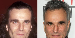 Daniel Day-Lewis: Good Genes or Good Docs?