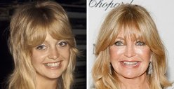 Goldie Hawn: Good Genes or Good Docs?