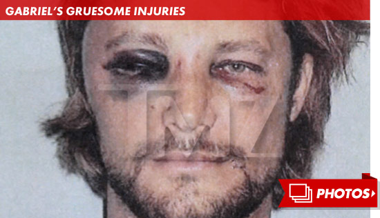 1126_gabriel_aubry_gruesome_injuries_footer