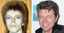 David Bowie: Good Genes or Good Docs?
