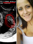"Teen Mom 2" Star Jenelle Evans Shows Off Sonogram