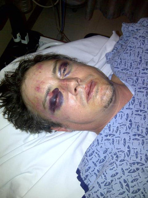 Jason London -- I'm the REAL Victim ... They BROKE My Face
