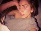Lady Gaga Undergoes Hip Surgery, Thanks Fans for Their Support