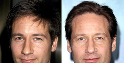 David Duchovny: Good Genes or Good Docs?