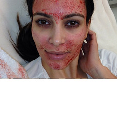 Video: Kim Kardashian's Bizarre (& Bloody) "Vampire" Facial