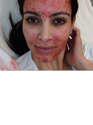 Video: Kim Kardashian's Bizarre (& Bloody) "Vampire" Facial