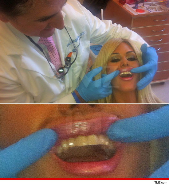 0320_shauna_sands_teeth_jewels_tmz