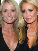 Kim Richards Opens Up About Nose Job & Painkiller-Free Recovery