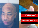 Rapper R. Prophet -- Graphic Post-Taser Photos