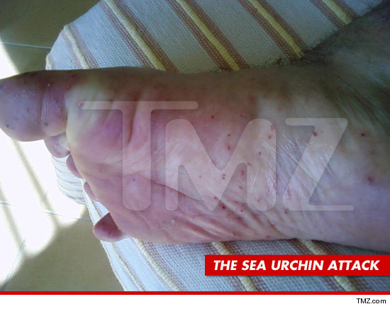 0425-eli-roth-tmz-urchin
