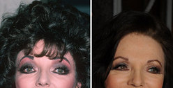 Joan Collins: Good Genes or Good Docs?