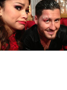 Zendaya Injures Val Chmerkovskiy -- See His Gross Eye Injury!