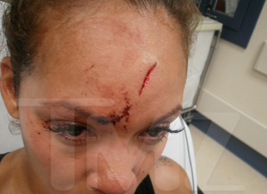 0617-evelyn-lozada-injuries-wm-1-630x400.jpg